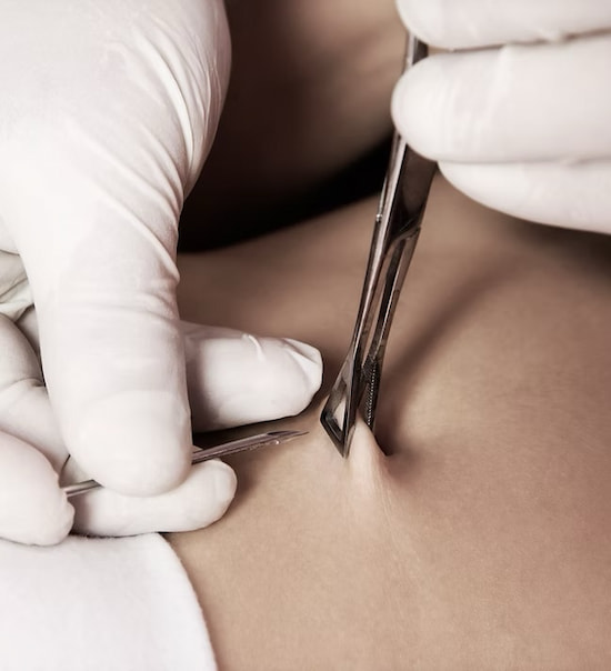 Piercing de ombligo en Arteixo